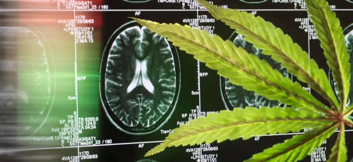 Alzheimer para tratamento com cannabis